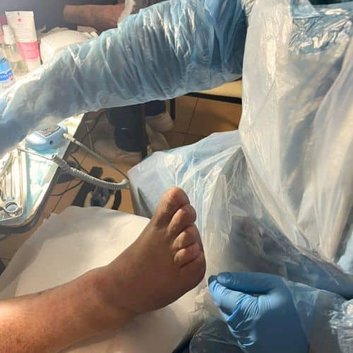 Calidad y Seguridad Garantizadas Servicio de podología de calidad en Quilpué