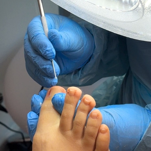Servicio de podología de calidad en Quilpué